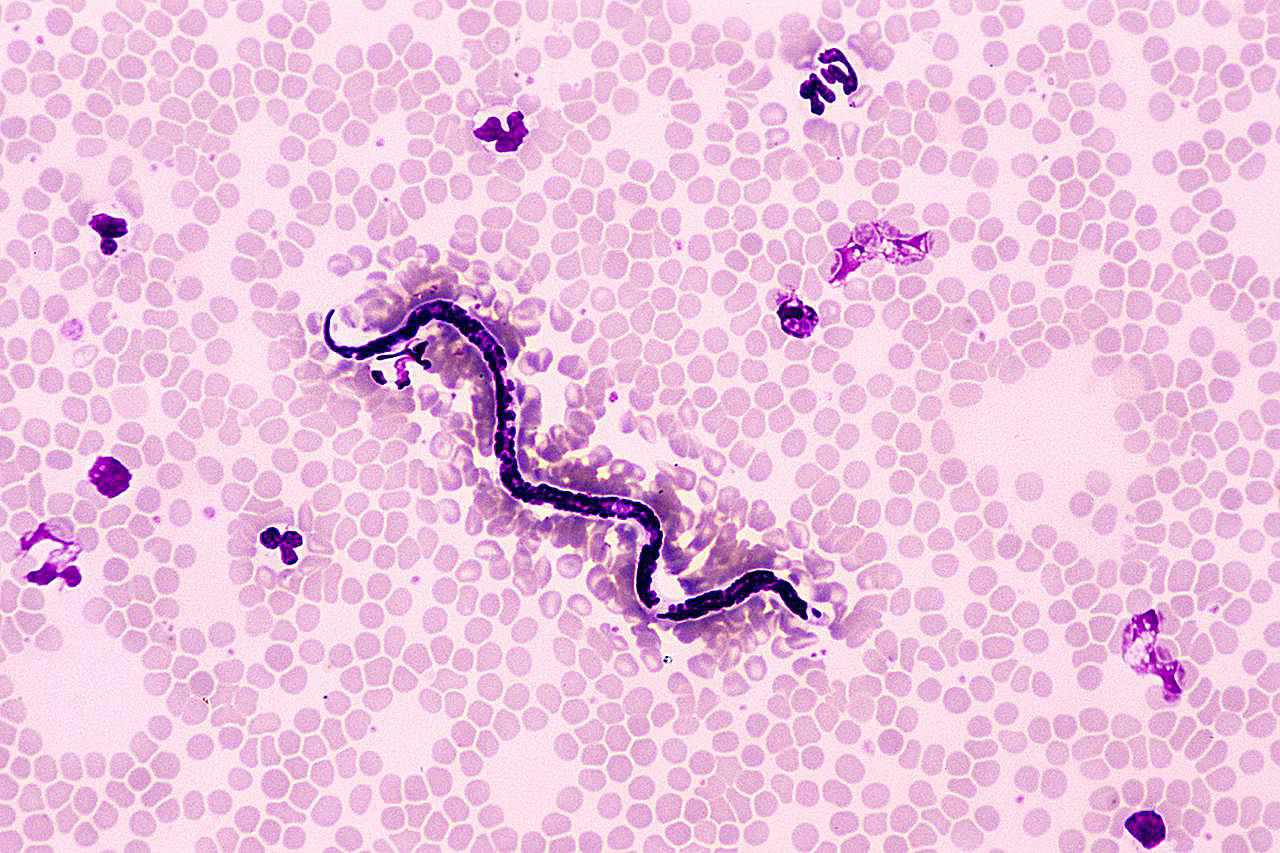 DOG HEART WORM. DIROFILARIA IMMITIS. MICROFILARIAE. BLOOD SMEAR, 100X at 35mm